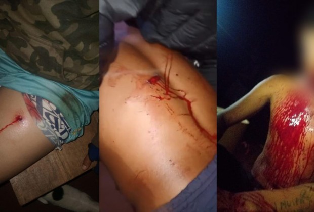 Imagens chocantes dos ferimentos causados a indígenas Avá-Guarani durante o ataque da noite de 3 de janeiro de 2025. Fotos: comunidade Avá-Guarani